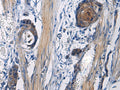 ICA1 Polyclonal Antibody – Figure 1 of 3
