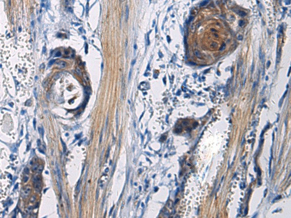 ICA1 Polyclonal Antibody – Figure 1 of 3