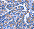 IGSF10 Polyclonal Antibody – Figure 1 of 2
