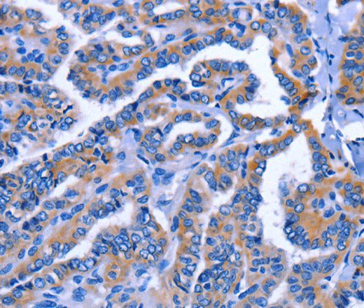 IGSF10 Polyclonal Antibody – Figure 1 of 2