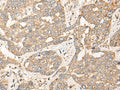 CPNE3 Polyclonal Antibody – Figure 1 of 3