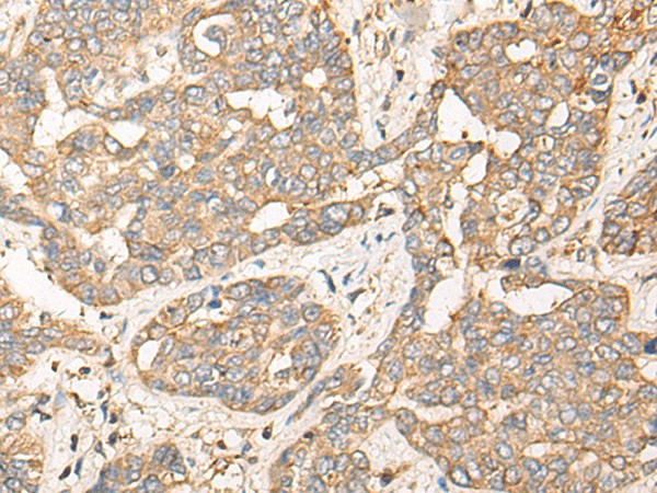 CPNE3 Polyclonal Antibody – Figure 1 of 3