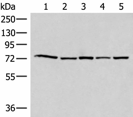 ATMIN Polyclonal Antibody – Figure 1 of 2