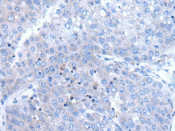 BTG4 Polyclonal Antibody – Figure 1 of 2