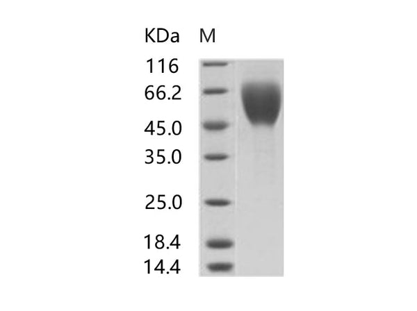 Recombinant EBOV (Subtype Sudan, strain Gulu) Glycoprotein / GP1 (mucin domain deleted) Protein (His Tag) – Figure 1 of 2