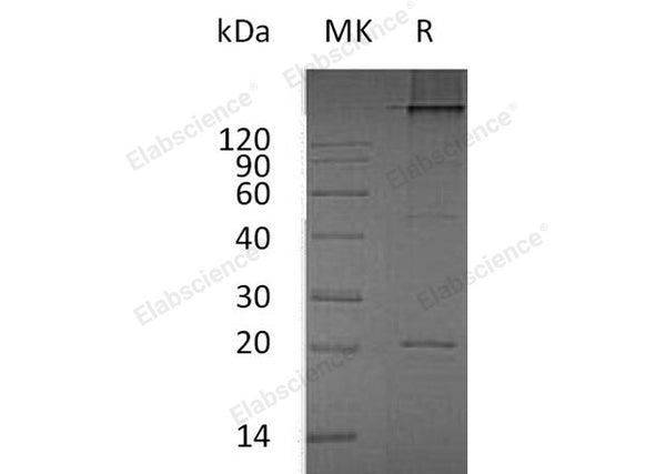 Recombinant Human RANKL/TNFSF11 Protein (His Tag) – Figure 1 of 2