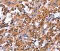 PIP5K1B Polyclonal Antibody – Figure 1 of 3