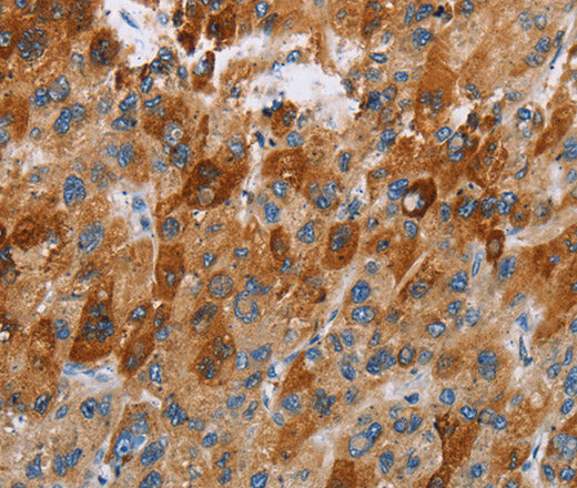 CCR9 Polyclonal Antibody – Figure 1 of 3
