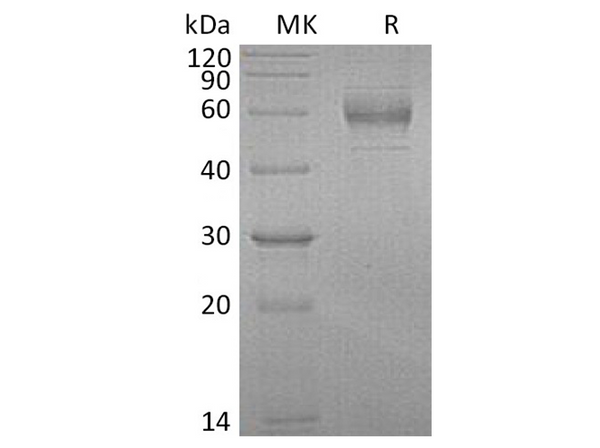 Recombinant Human GFRA1/GDNFRA Protein (aa 25-429, His Tag) – Figure 1 of 2