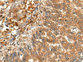 MARK3 Polyclonal Antibody – Figure 1 of 2