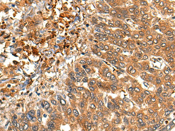 MARK3 Polyclonal Antibody – Figure 1 of 2