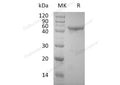 Recombinant Human OX40/TNFRSF4 Protein (Fc Tag) – Figure 1 of 2