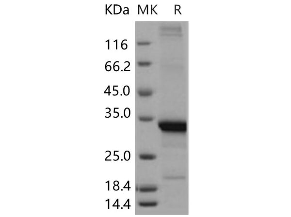 Recombinant Human Beta-amyloid 42/Beta-APP42 Protein (His & GST Tag) – Figure 1 of 2