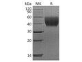 Recombinant Human IL10-RA/IL-10 Rα Protein (His Tag) – Figure 1 of 2