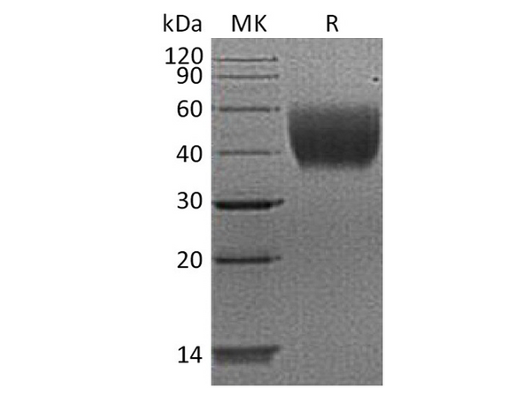 Recombinant Human IL10-RA/IL-10 Rα Protein (His Tag) – Figure 1 of 2