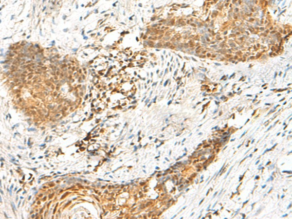 HMBOX1 Polyclonal Antibody – Figure 1 of 2