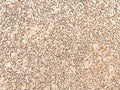 CCNE1 Polyclonal Antibody – Figure 1 of 3