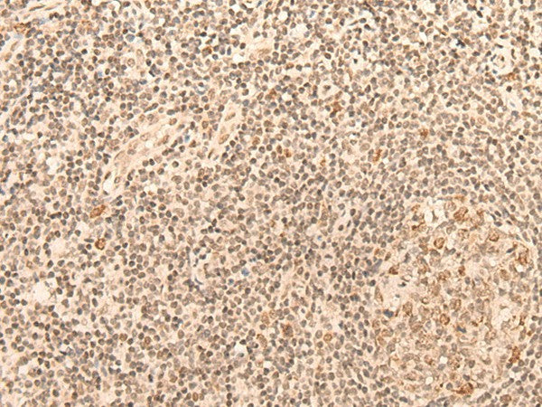 CCNE1 Polyclonal Antibody – Figure 1 of 3