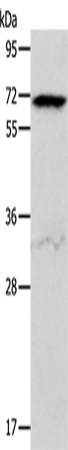 ACVR2A Polyclonal Antibody – Figure 1 of 2