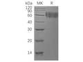 Recombinant Human DR6/TNFRSF21 Protein (His Tag) – Figure 1 of 2