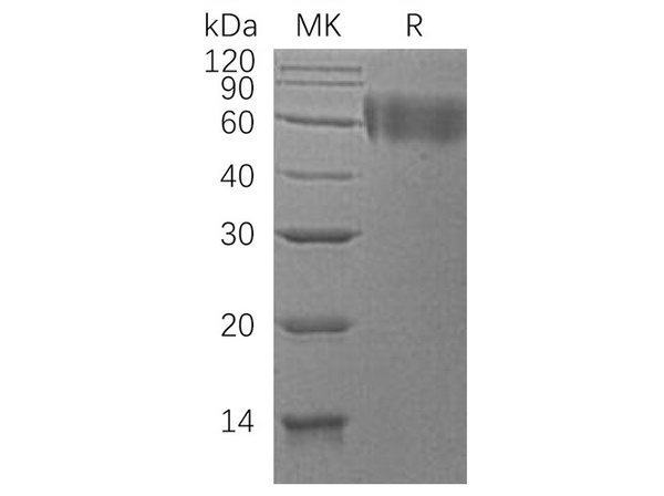 Recombinant Human DR6/TNFRSF21 Protein (His Tag) – Figure 1 of 2