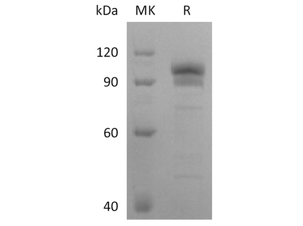 Recombinant Human EphB2 Protein (Fc Tag) – Figure 1 of 2