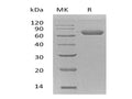 Recombinant Mouse Ephrin-B2/EFNB2 Protein (Fc & His Tag) – Figure 1 of 2