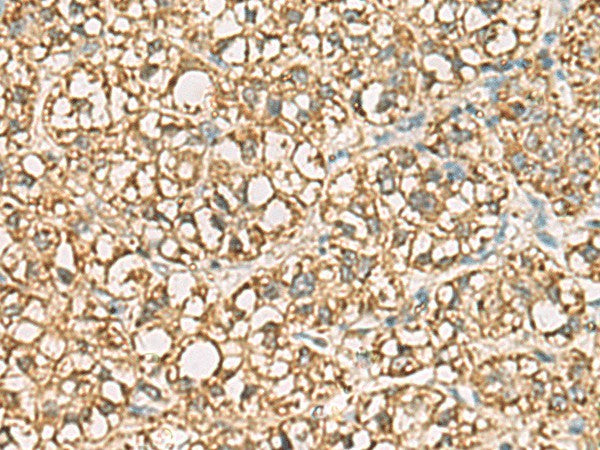 VTA1 Polyclonal Antibody – Figure 1 of 3