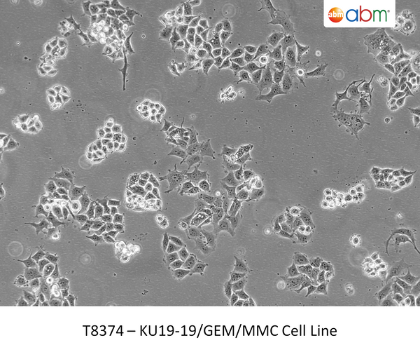 KU19-19/GEM/MMC Cell Line | Applied Biological Materials (abm)