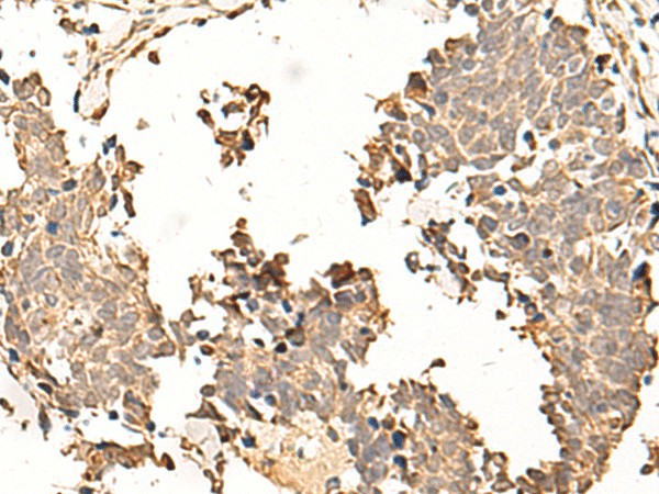 SOX3 Polyclonal Antibody – Figure 1 of 3