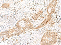 PRKAG2 Polyclonal Antibody – Figure 1 of 2