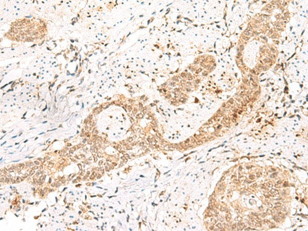 PRKAG2 Polyclonal Antibody – Figure 1 of 2