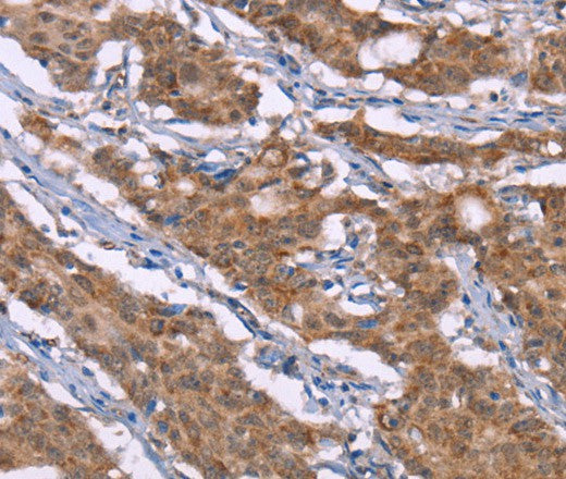 Histamine H3 Receptor Polyclonal Antibody – Figure 1 of 3