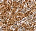 NLRP7 Polyclonal Antibody – Figure 1 of 3