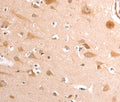TRPV4 Polyclonal Antibody – Figure 1 of 3
