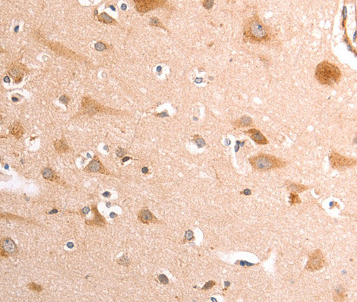 TRPV4 Polyclonal Antibody – Figure 1 of 3