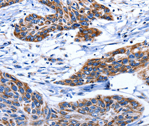 AQP8 Polyclonal Antibody – Figure 1 of 2