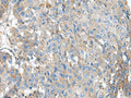 KIAA0556 Polyclonal Antibody – Figure 1 of 3