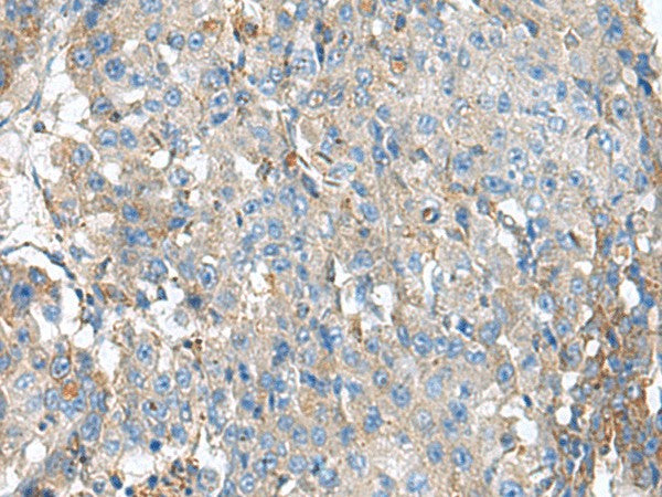 KIAA0556 Polyclonal Antibody – Figure 1 of 3