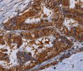 MFAP3L Polyclonal Antibody – Figure 1 of 2