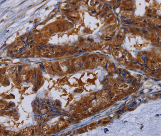 MFAP3L Polyclonal Antibody – Figure 1 of 2