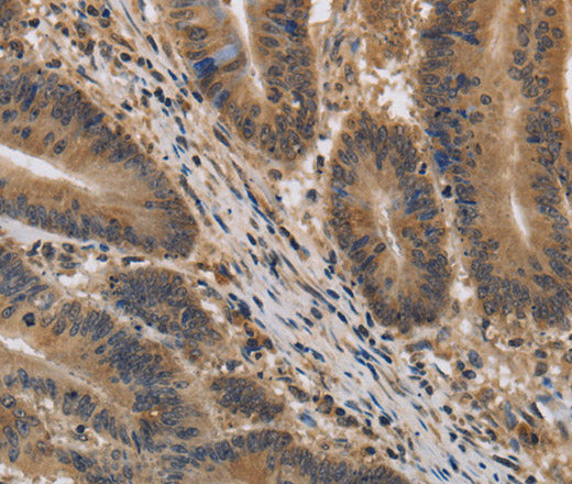 KIF22 Polyclonal Antibody – Figure 1 of 3