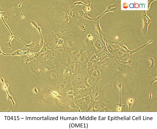 Immortalized Human Middle Ear Epithelial Cell Line (OME1) | Applied Biological Materials (abm)
