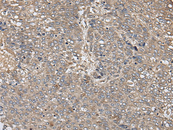 ZFP36 Polyclonal Antibody – Figure 1 of 3
