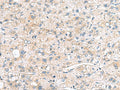 MYL1 Polyclonal Antibody – Figure 1 of 3