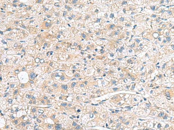MYL1 Polyclonal Antibody – Figure 1 of 3