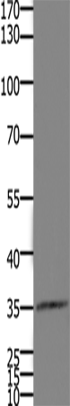 HOXD11 Polyclonal Antibody – Figure 1 of 2