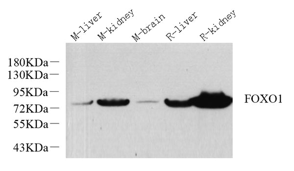 FOXO1 Polyclonal Antibody – Figure 1 of 2