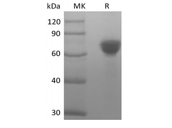 Recombinant Human Tumor-associated Calcium Signal Transducer 2/TROP-2 (248AA, C-Fc) – Figure 1 of 2