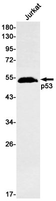 Recombinant p53 Monoclonal Antibody – Figure 1 of 3